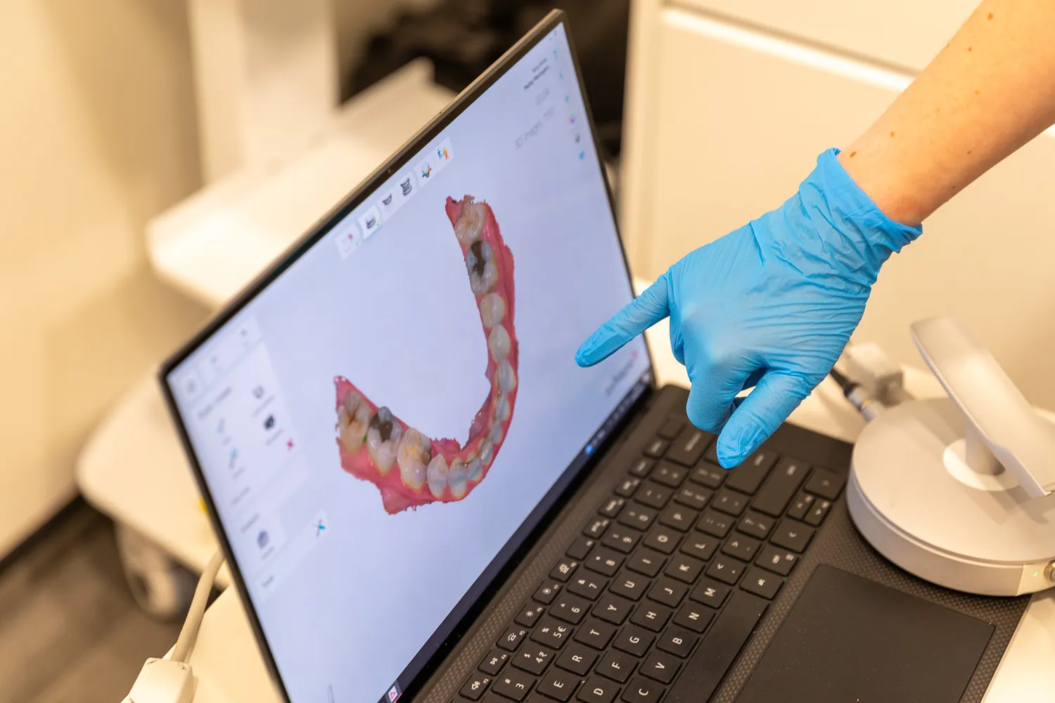 Digital scan of teeth