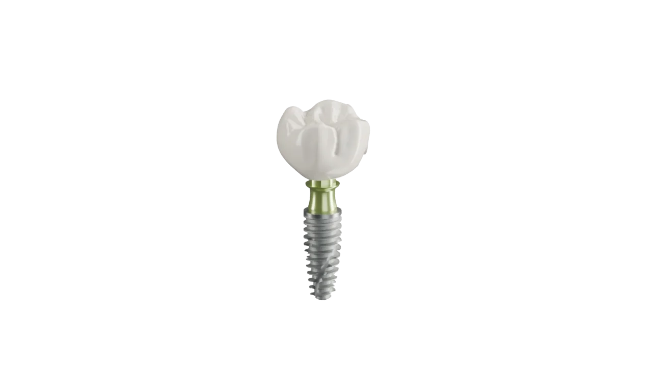 A single dental implant with its crown