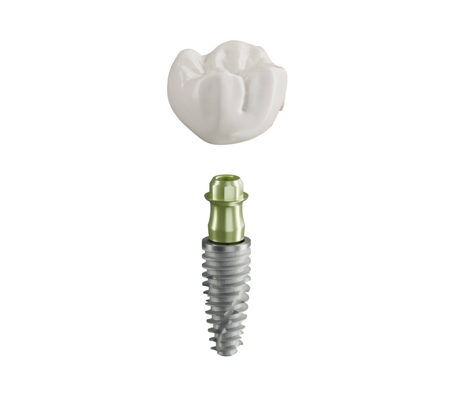 Single Implant